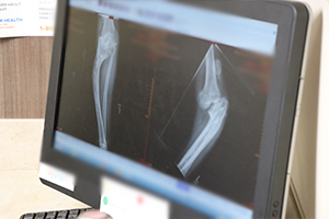 before and after xrays