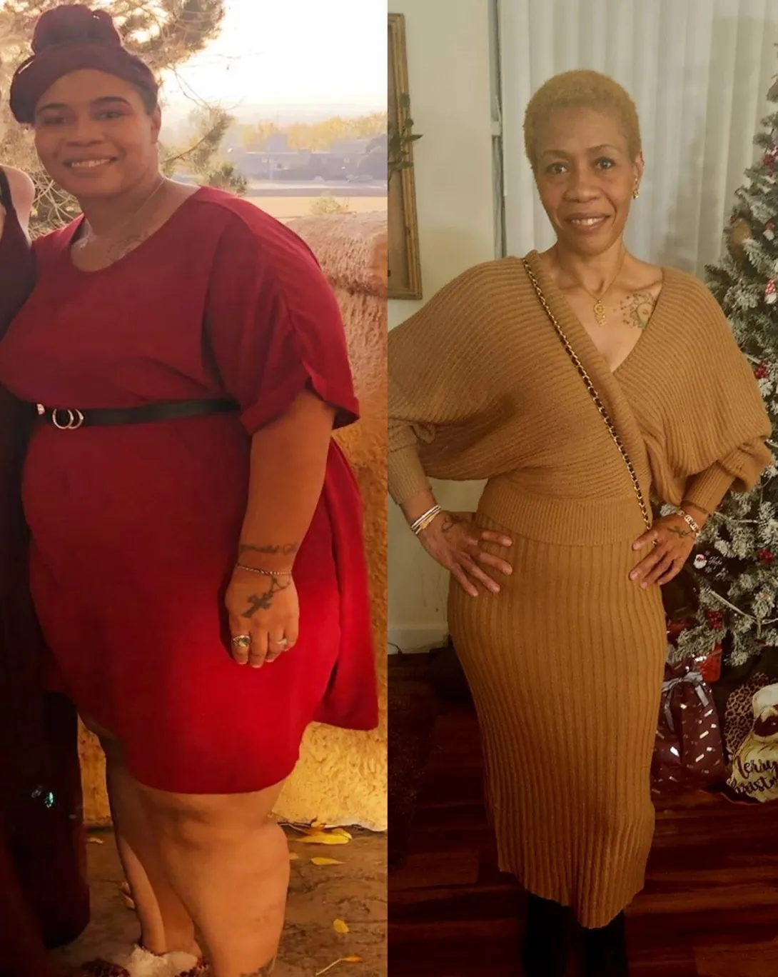 Before and After Bariatric Surgery Series